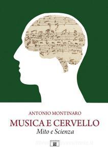 CERVELLO IN GIOSTRA SCARICARE