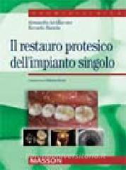 Il restauro protesico dellimpianto singolo.pdf