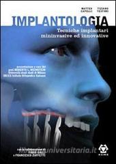 Implantologia. Tecniche implantari mininvasive e innovative.pdf