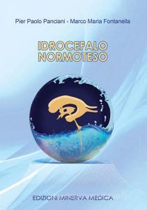 Idrocefalo normoteso.pdf
