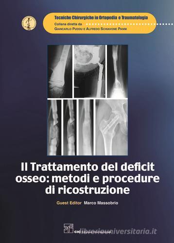 Il trattamento del deficit osseo: metodi e procedure di ricostruzione edito da CIC Edizioni Internazionali