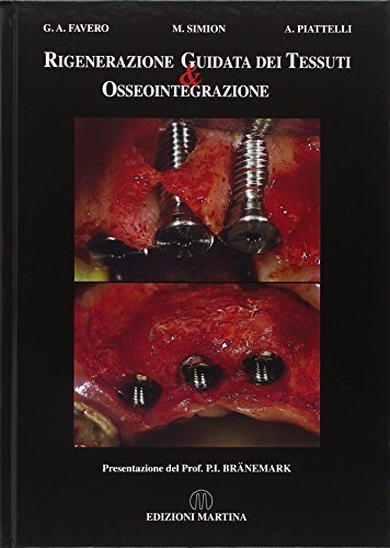 Rigenerazione guidata dei tessuti e osseointegrazione di Gianfranco Favero, Massimo Simion, Adriano Piattelli edito da Martina
