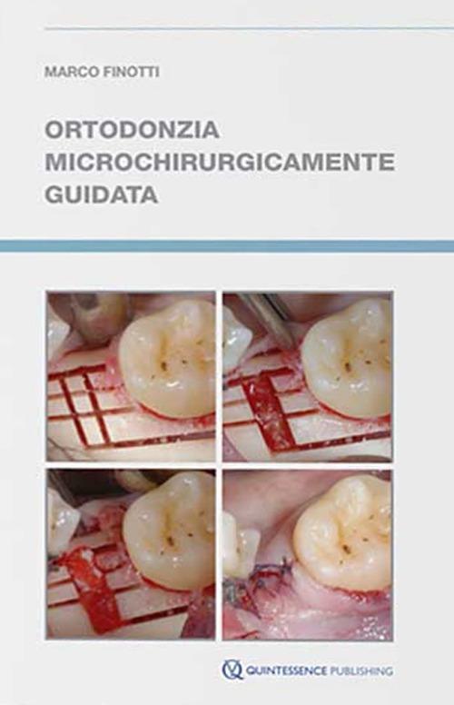 Ortodonzia microchirurgicamente guidata di Marco Finotti edito da Quintessenza