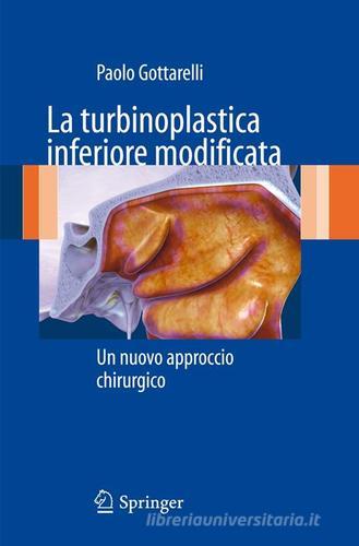 La turbinoplastica inferiore modificata. Un nuovo approccio chirurgico di Paolo Gottarelli edito da Springer Verlag