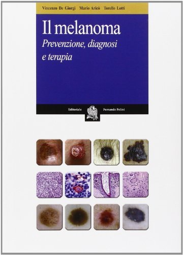 Il melanoma. Prevenzione, diagnosi e terapia di Vincenzo De Giorgi, Mario Aricò, M. Lotti Torello edito da Folini