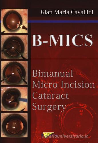 B-MICS Bimanual micro incision cataract surgery di Gian Maria Cavallini edito da Athena Audiovisuals