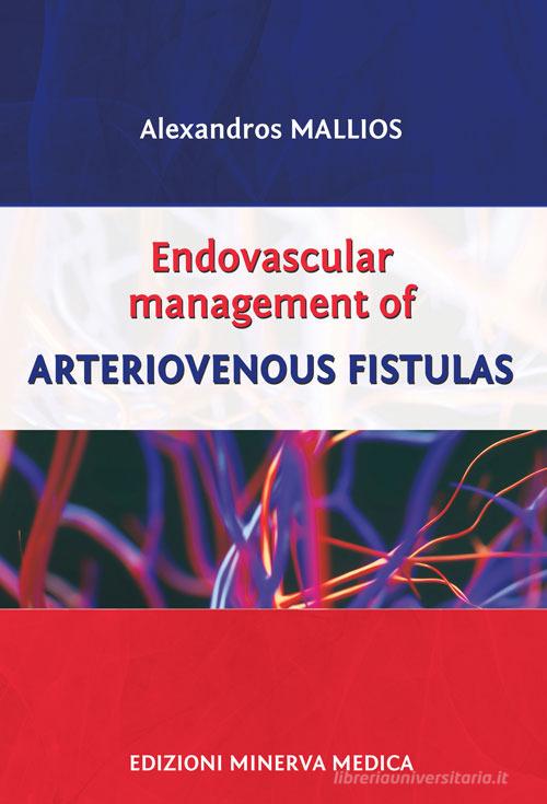 Endovascular management of arteriovenous fistulas di Alexandros Mallios edito da Minerva Medica