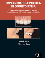 Implantologia pratica in odontoiatria. Trattato sugli aspetti diagnostici, chirurgici, protesici e tecnici dell'armonia estetica e funzionale di Ashok Sethi, Thomas Kaus edito da Quintessenza