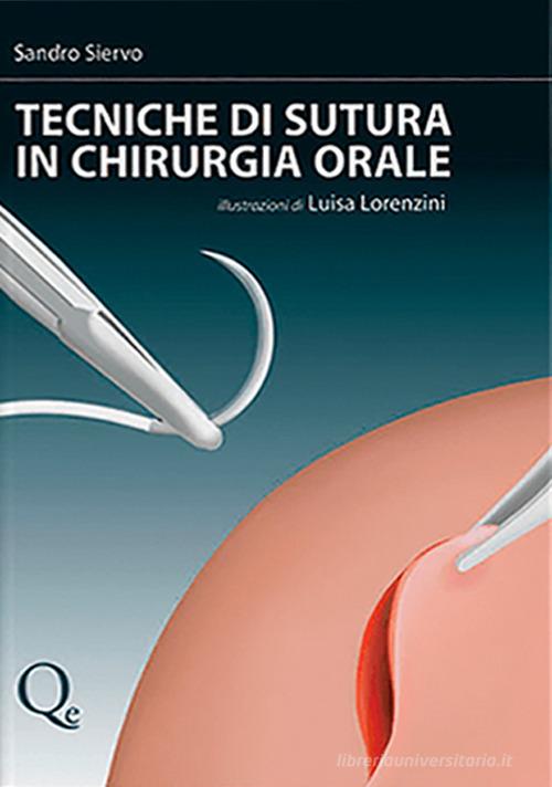 Tecniche di sutura in chirurgia orale di Sandro Siervo, Luisa Lorenzini edito da Quintessenza