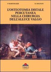 L' osteotomia distale percutanea della chirurgia dell'alluce valgo di Pietro Bartolozzi, Bruno Magnan edito da Timeo