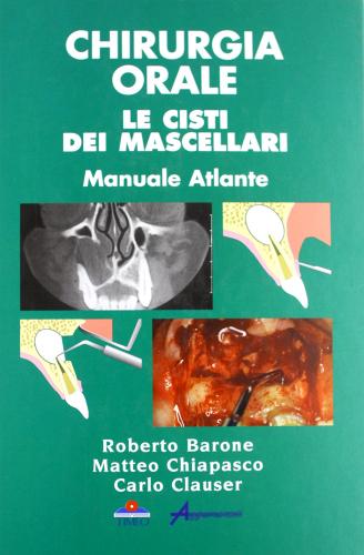 Chirurgia orale. Le cisti dei mascellari di Roberto Barone, Matteo Chiapasco, Carlo Clauser edito da Timeo