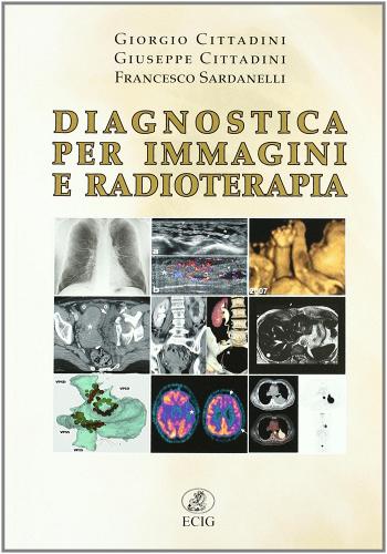 Diagnostica per immagini e radioterapia di Giorgio Cittadini, Giuseppe Cittadini, Francesco Sardanelli edito da ECIG