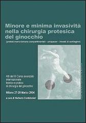 Minore e minima invasività nella chirurgia protesica del ginocchio. Protesi mono-bimono compartimentali, unispacer, innesti di cartilagine. DVD-ROM di Norberto Confalonieri edito da Timeo