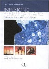 Infezione perimplantare: eziologia, diagnosi e trattamento di Frank Schwarz, Jürgen Becker edito da Quintessenza