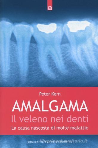 Amalgama. Il veleno nei denti. La causa nascosta di molte malattie di Peter Kern edito da Edizioni Il Punto d'Incontro