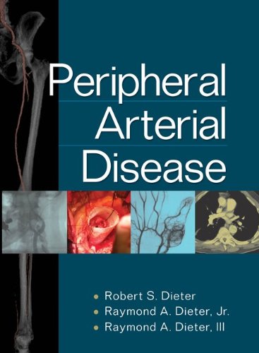 Peripheral arterial disease edito da McGraw-Hill Education