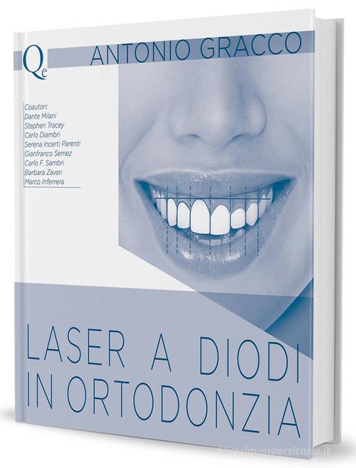 Laser a diodi in ortodonzia di Antonio Gracco edito da Quintessenza