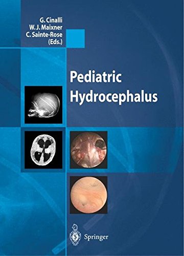 Pediatric hydrocephalus edito da Springer Verlag