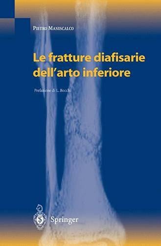 Le fratture diafisarie dell'arto inferiore di Pietro Maniscalco edito da Springer Verlag