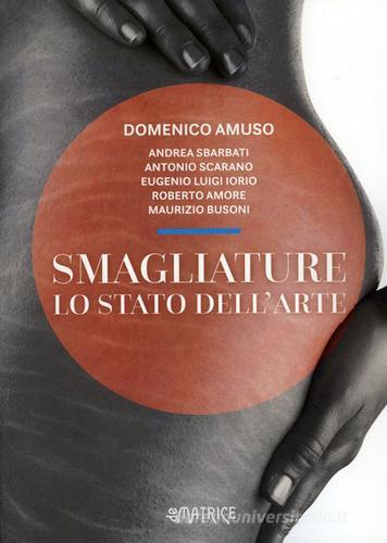 Smagliature. Lo stato dell'arte di Domenico Amuso edito da De Matrice