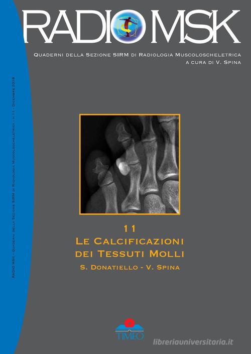 Le calcificazioni dei tessuti molli. Ediz. illustrata di Salvatore Donatiello, Vincenzo Spina edito da Timeo