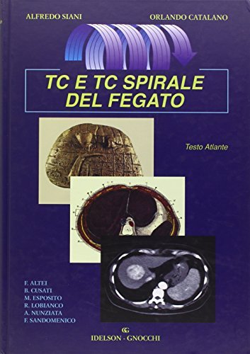 TC e TC spirale del fegato di Alfredo Siani, Orlando Catalano edito da Idelson-Gnocchi