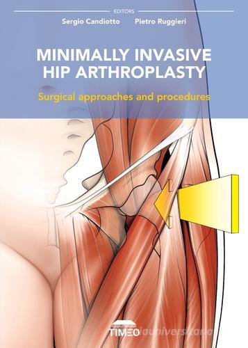 Minimally invasive hip arthroplasty. Surgical approaches and procedures di Sergio Candiotto, Pietro Ruggieri edito da Timeo