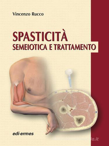 Spasticità. Semeiotica e trattamento di Vincenzo Rucco edito da Edi. Ermes