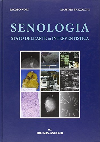 Senologia. Stato dell'arte di interventistica di Jacopo Nori, Massimo Bazzocchi edito da Idelson-Gnocchi
