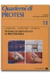 Preparazioni parziali in protesi fissa di Andrea Brusoni, Maurizio De Carli, Monica Imelio edito da Elsevier