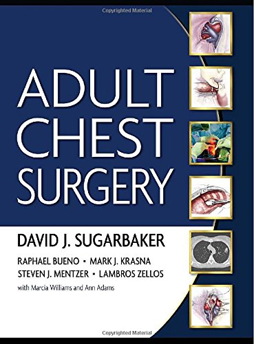 Adult chest surgery edito da McGraw-Hill Education