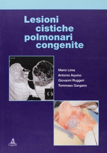 Lesioni cistiche polmonari congenite di Mario Lima, Antonio Aquino, Giovanni Ruggeri edito da CLUEB