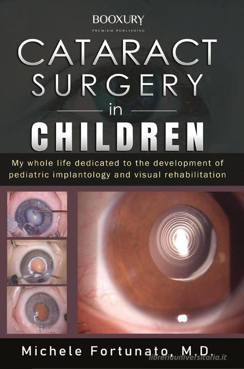 Cataract surgery in children di Michele Fortunato edito da Youcanprint