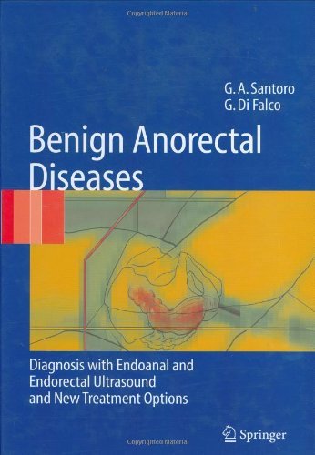 Benign anorectal diseases di Giulio A. Santoro, Giuseppe Di Falco edito da Springer Verlag