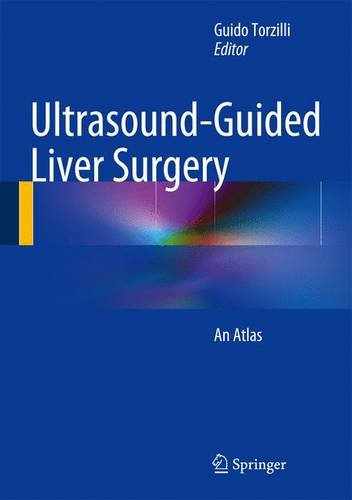 Ultrasound-guided liver surgery. An Atlas edito da Springer Verlag