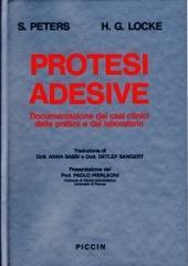 Protesi adesive. Documentazione di casi clinici dalla pratica e dal laboratorio di Siegwart Peters, Hans G. Locke edito da Piccin-Nuova Libraria