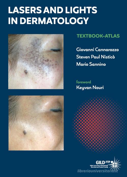 Lasers and lights in dermatology. Textbook-atlas di Giovanni Cannarozzo, Steven Paul Nisticò, Mario Sannino edito da Medimia Press