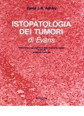 Istopatologia dei tumori di Evans di David J. Ashley edito da Piccin-Nuova Libraria