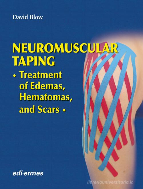 Neuromuscular taping. Treatment of edemas, hematomas and scars di David Blow edito da Edi. Ermes