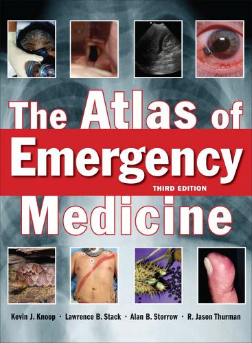 The atlas of emergency medicine edito da McGraw-Hill Education