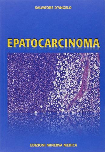Epatocarcinoma di Salvatore D'Angelo, Paolo Sorrentino, Mario Secondulfo edito da Minerva Medica