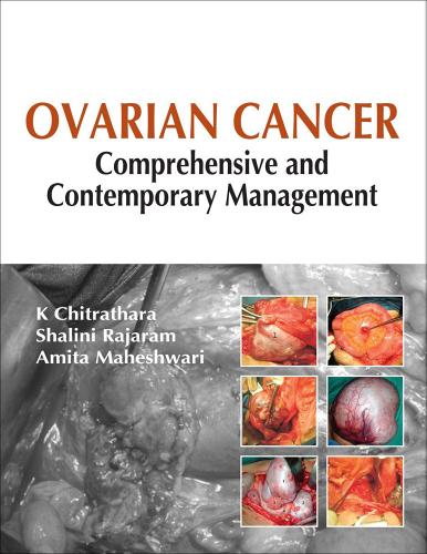 Ovarian cancer: comprehensive and contemporary management di K. Chitrathara, Shalini Rajaram, Amita Maheshwari edito da McGraw-Hill Education
