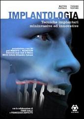 Implantologia. Tecniche implantari mininvasive e innovative di Matteo Capelli, Tiziano Testori edito da Acme (Viterbo)