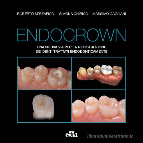 Endocrown. Una nuova via per la ricostruzione dei denti trattati endodonticamente di Roberto Spreafico, Simona Chirico, Massimo Gagliani edito da Edra