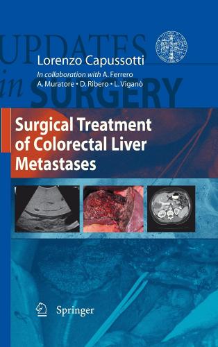 Surgical treatment of colorectal liver metastases di Alessandro Ferrero, Andrea Muratore, Dario Ribero edito da Springer Verlag