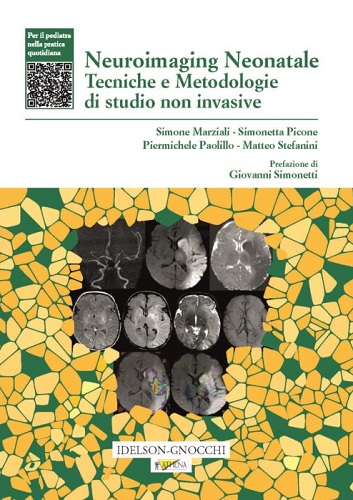 Neuroimaging neonatale. Tecniche e metodologie di studio non invasive di Simone Marziali, Simonetta Picone, Piermichele Paolillo edito da Idelson-Gnocchi