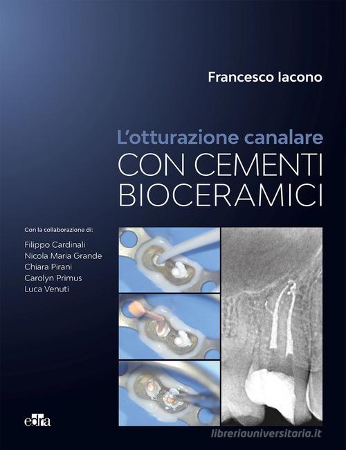 L'otturazione canalare con cementi bioceramici di Francesco Iacono edito da Edra