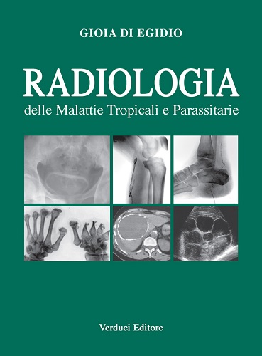 Radiologia delle malattie tropicali e parassitarie di Gioia Di Egidio edito da Verduci