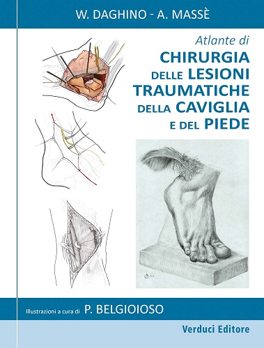 Atlante di chirurgia delle lesioni traumatiche della caviglia e del piede di W. Daghino edito da Verduci
