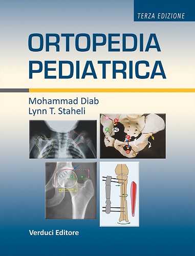 Ortopedia pediatrica di Mohammad Diab edito da Verduci